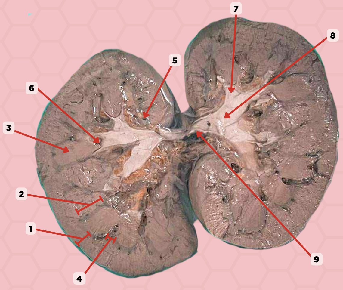 <p>Pin 8 is formed by converging of 2 to 3 ____?</p><p>a. renal pyramids</p><p>b. major calyces</p><p>c. minor calyces</p><p>d. renal columns of Bertin</p>