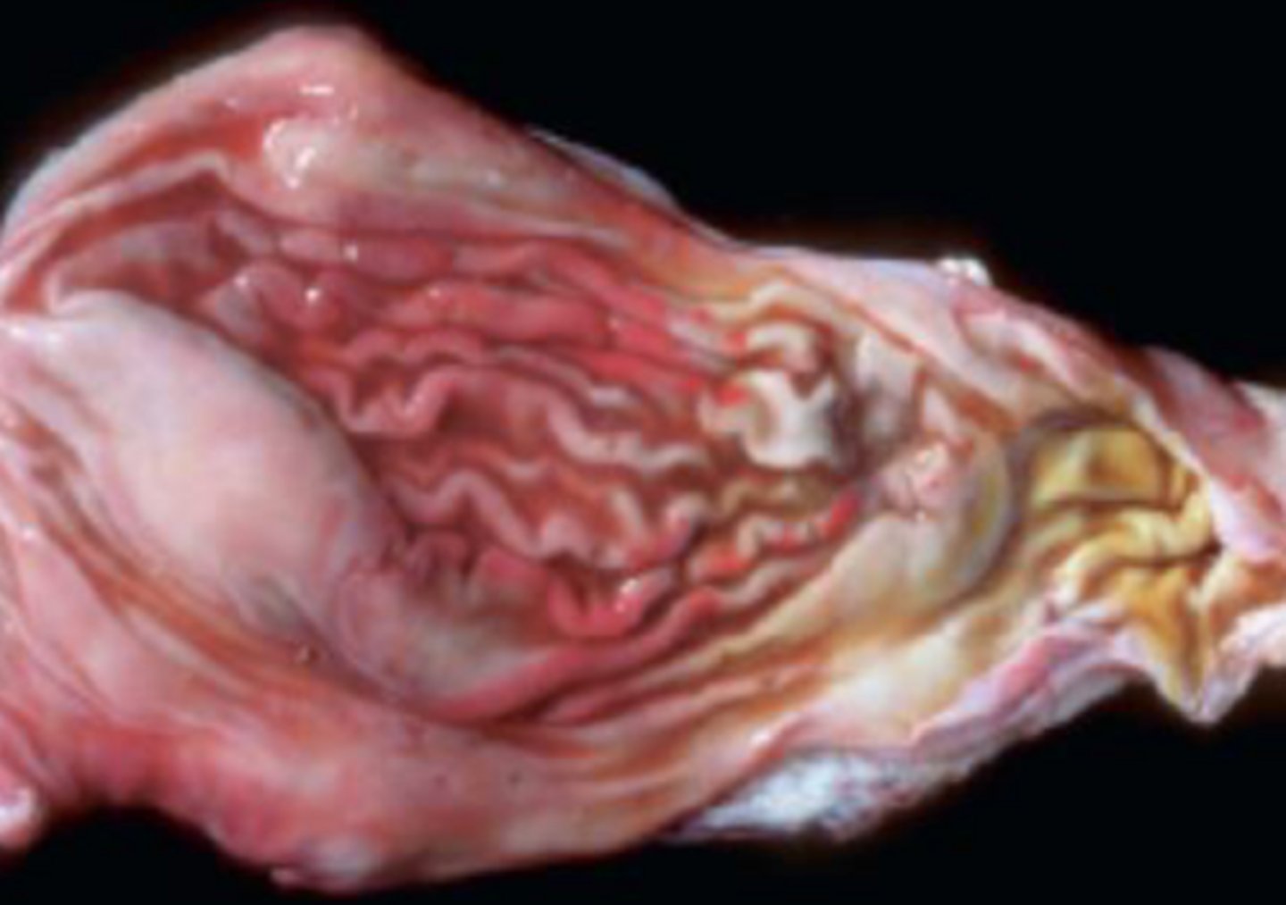 <p>What will you see in uremic gastritis?</p>