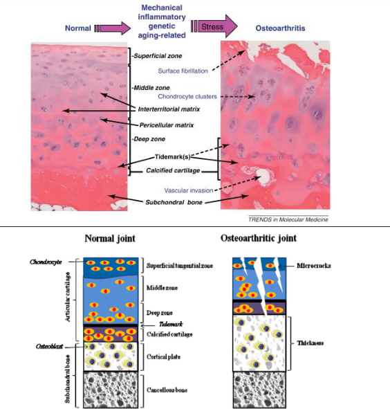 <p>MEDISCHE TOEPASSING: OSTEOARTHROSE (osteoarthritis)</p>
