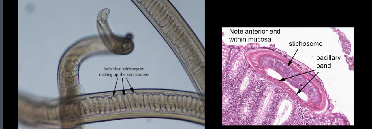 <p>Name the genus and segment </p>