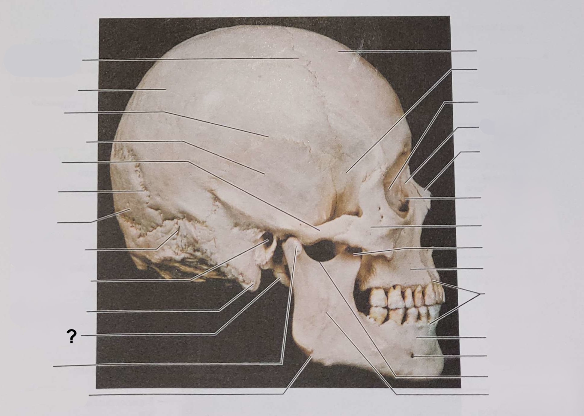 <p>Name the indicated structure</p>