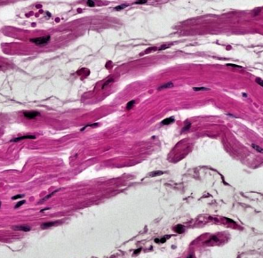 <p><span>Identify this muscle tissue, its location, and its function.</span></p>