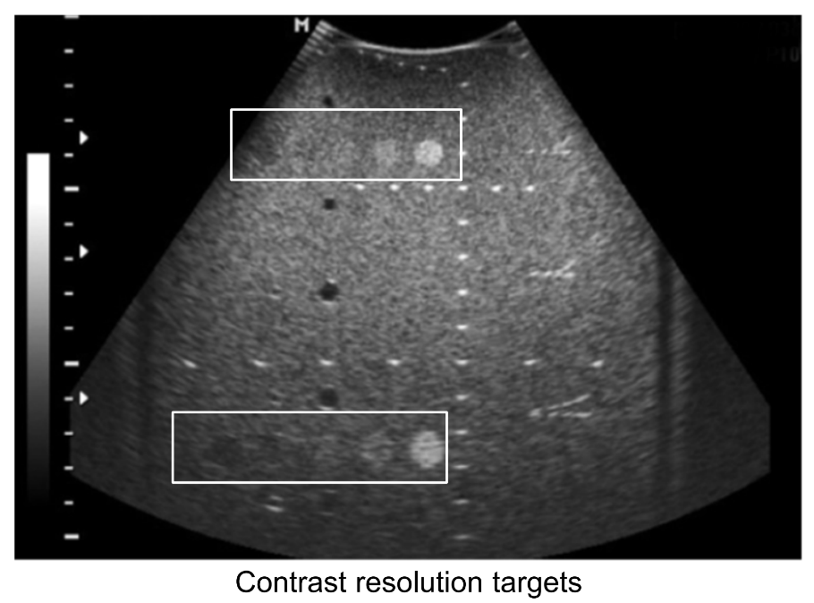 <p>By evaluating targets of different echogenicity. This assesses grayscale contrast and targets different echogenicity on the TE phantom.</p>