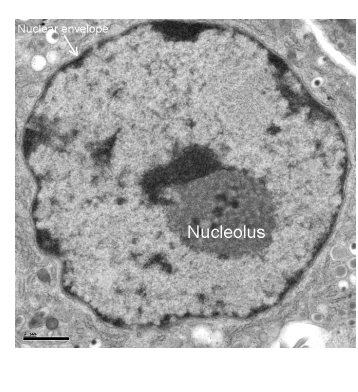 <ul><li><p>Dense, spherical structure in nucleus</p></li><li><p>composed of DNA, RNA and protein</p></li><li><p>Site of ribosome synthesis</p></li></ul><p></p>