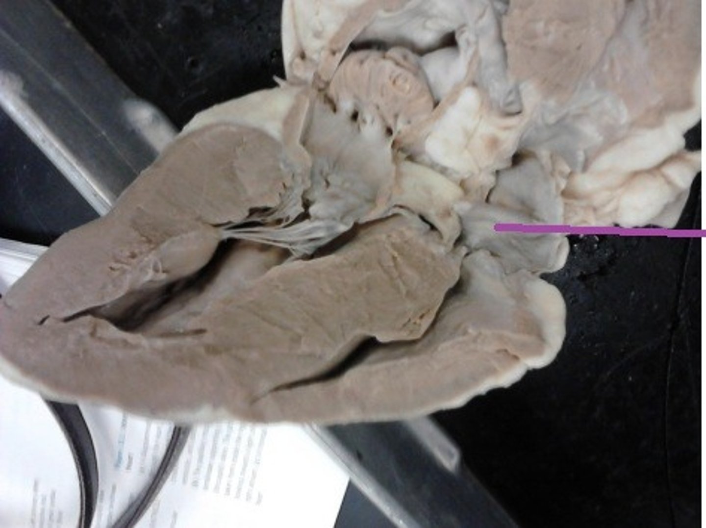 <p>Identify the chamber.</p>