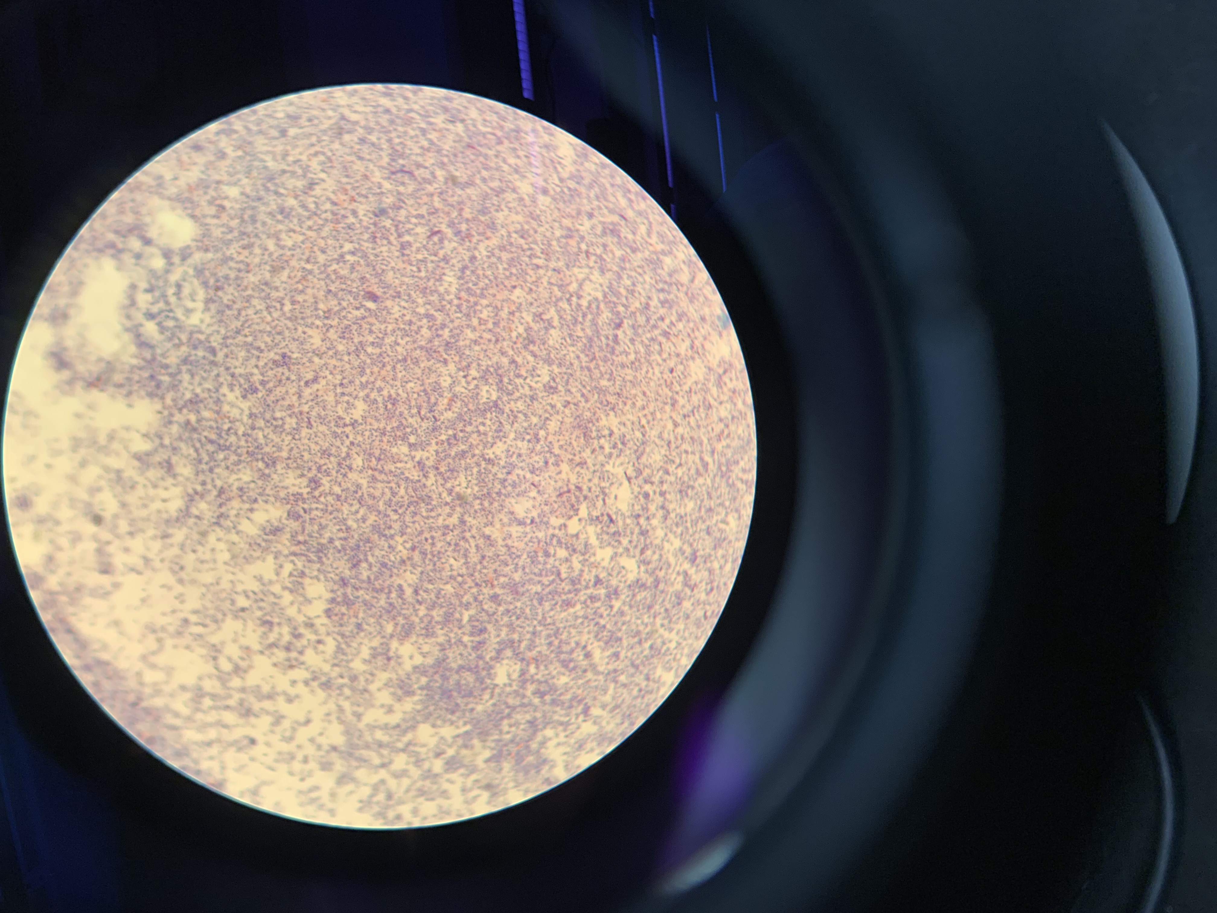 <p>what are the results of this gram stain</p>