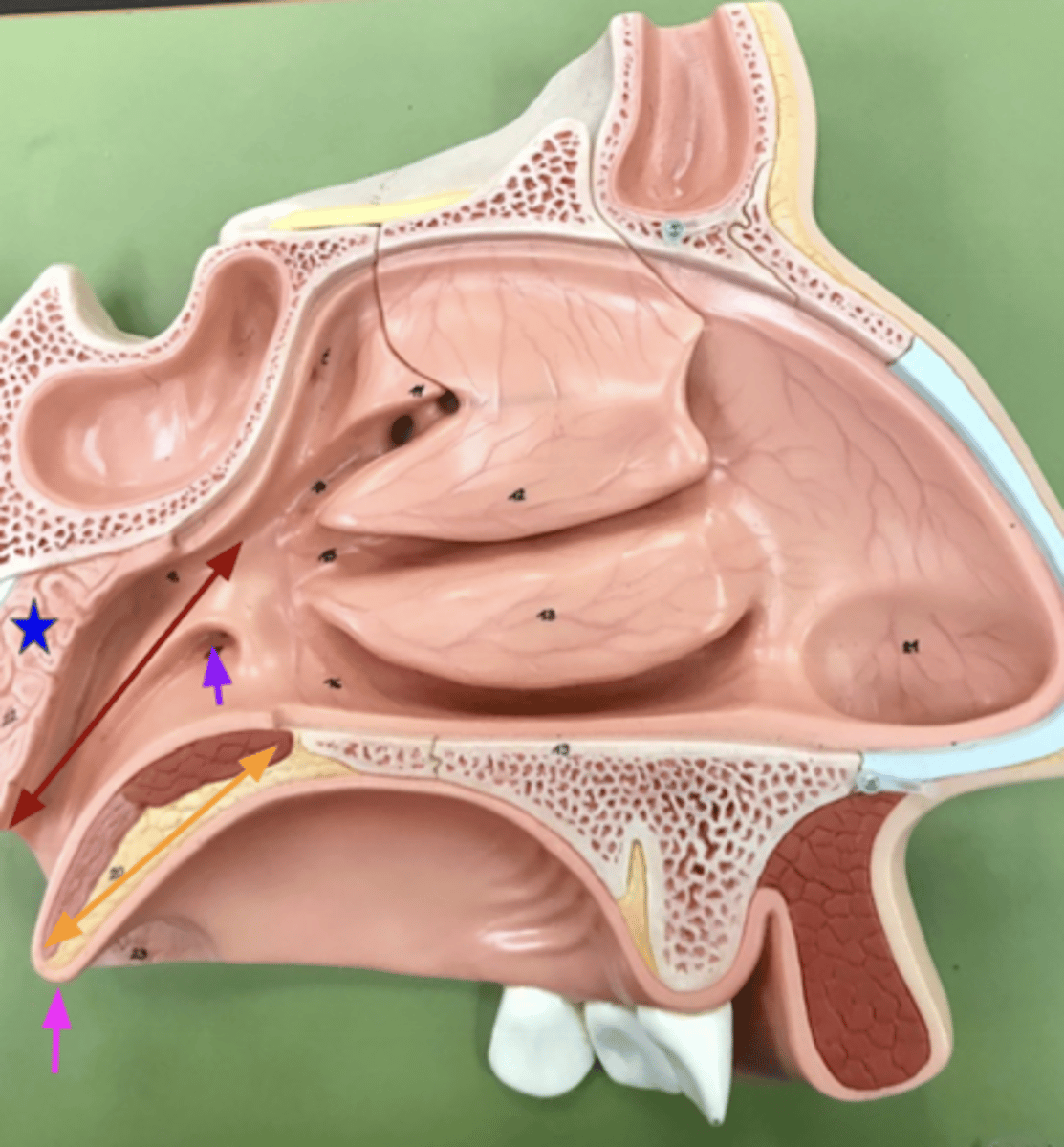 <p>What is the pink arrow?</p>