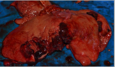 <p>Describe the texture of this liver</p>