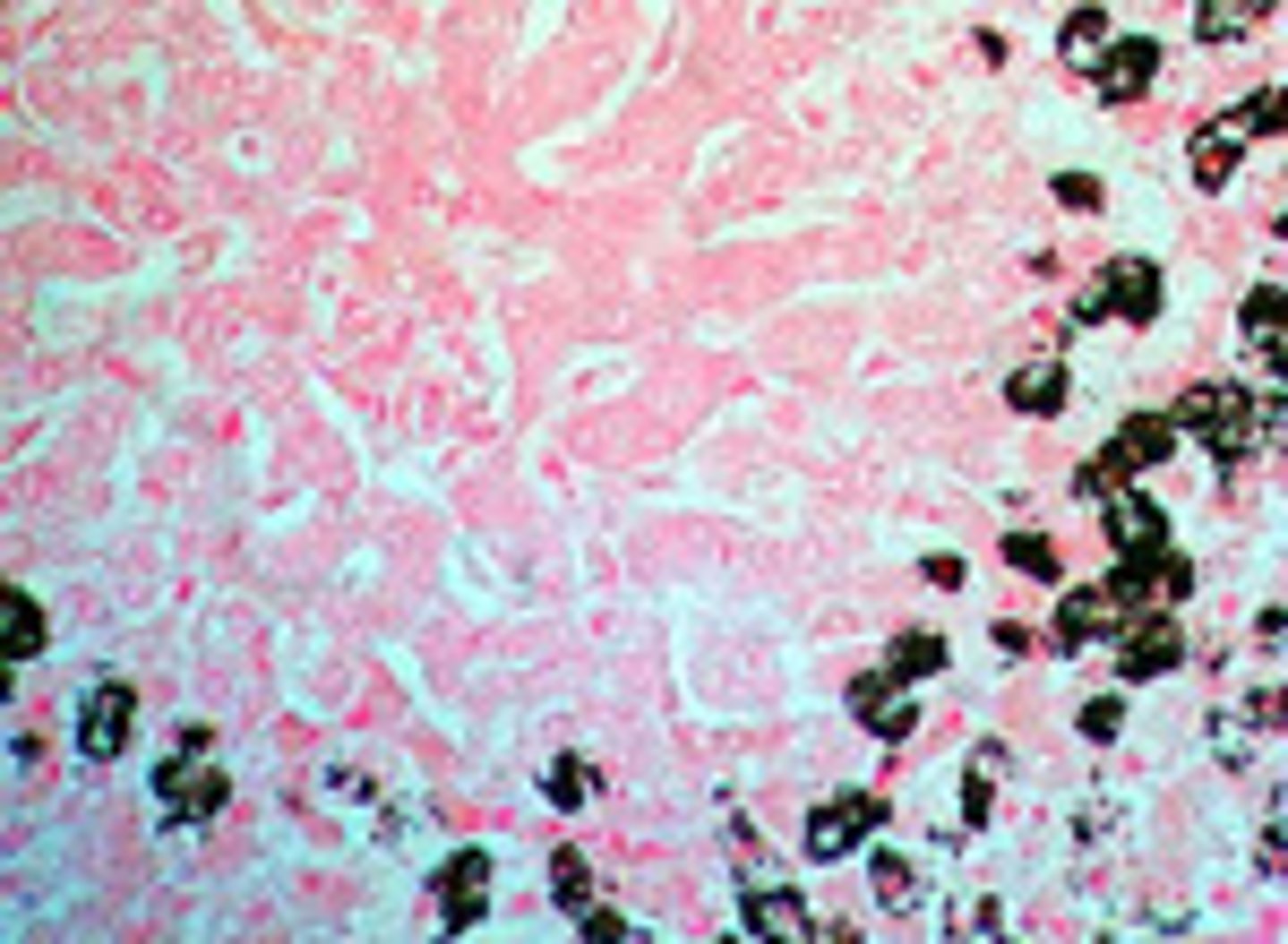 <p>Calcium</p><p>3 multiple choice options</p>