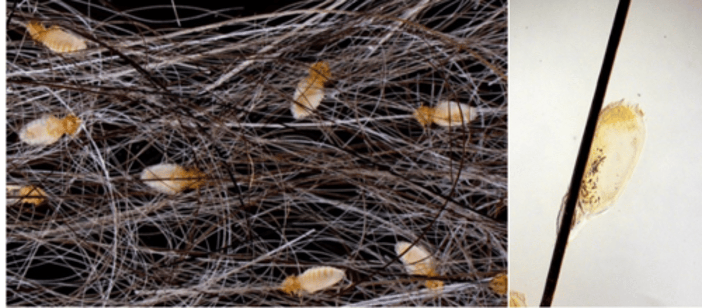 <p>Clinical signs;</p><p>Finding lice and/or eggs on the body of the cats</p>