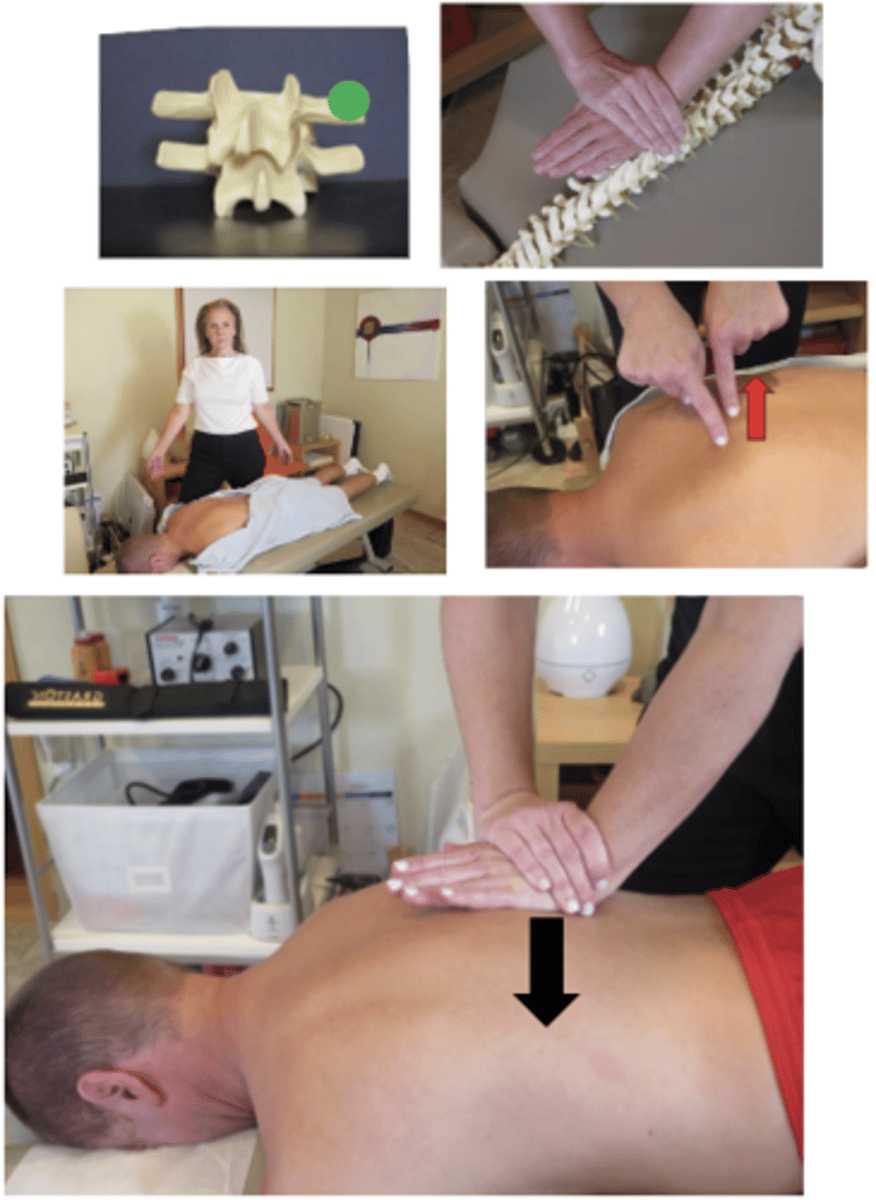 <p>• PP: Prone, asks permission to open gown/contact patient, verbalize finding the segment</p><p>• DP: Fencer or square stance facing cephalad, side of adjustive contact, tissue slack M-L</p><p>• CH: Hypothenar of caudal hand on Transverse Process (TP) (fingers running parallel to the spine)</p><p>• IH: Pisiform in anatomical snuff box ofCH, with fingers around wrist.</p><p>• Vector: P-A</p>