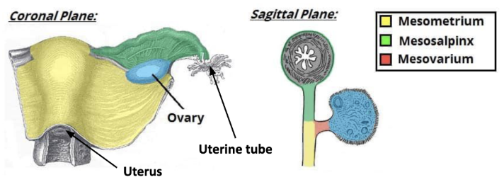 <ul><li><p><span style="background-color: transparent;"><u><span>mesometrium</span></u><span> - covers uterus</span></span></p></li><li><p><span style="background-color: transparent;"><u><span>mesosalpinx</span></u><span> - covers uterine tube</span></span></p></li><li><p><span style="background-color: transparent;"><u><span>mesovarium</span></u><span> - covers ovarian ligament and ovaries&nbsp;</span></span></p></li></ul><p></p>