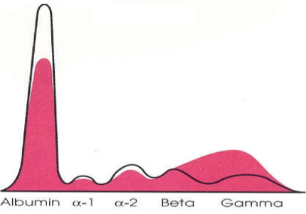 <p>Not making normal proteins</p><p>classic beta-gamma bridge </p>