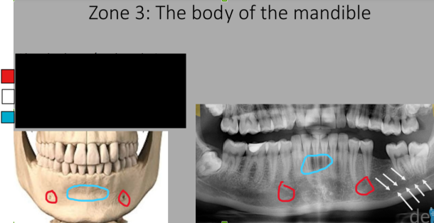 <p>What do we see in Zone 3?</p>