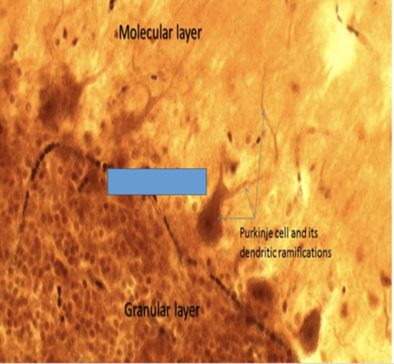 <p>Identify the layer of the cerebellum</p>