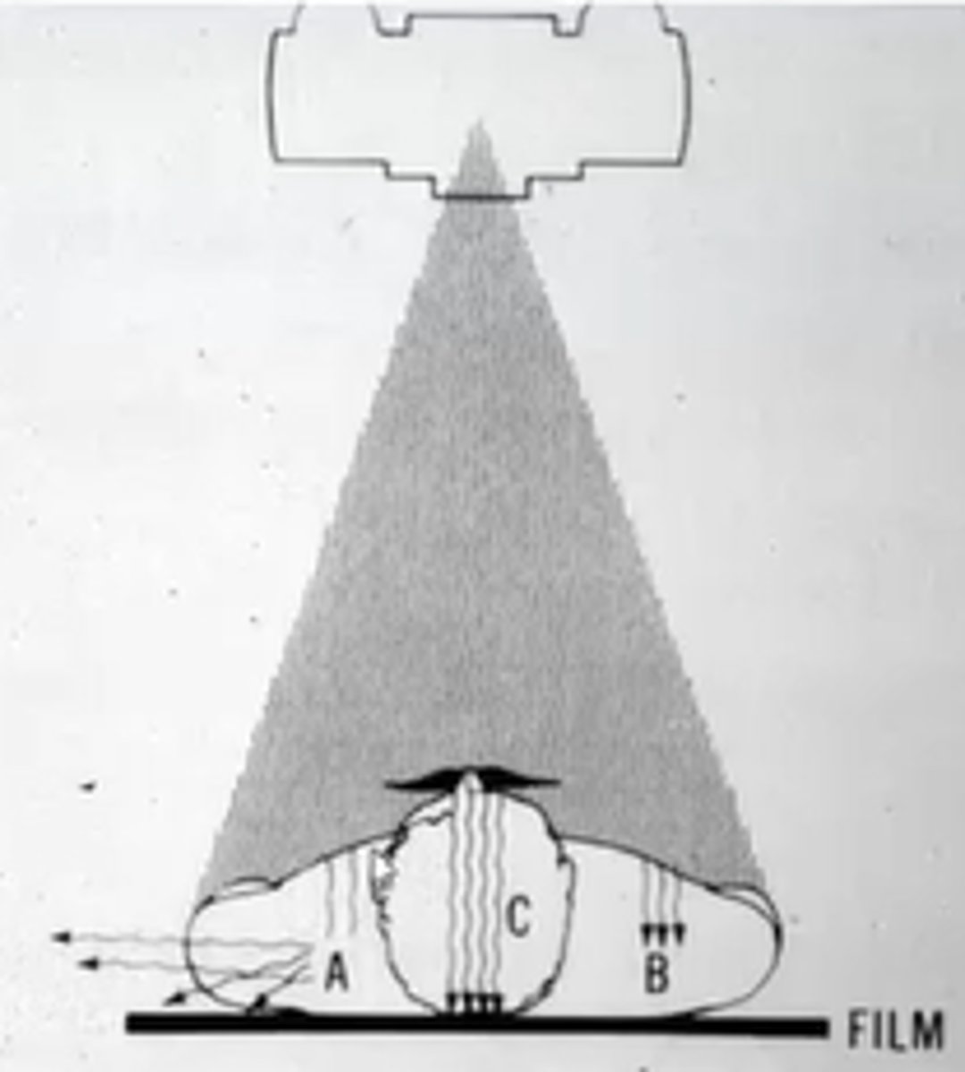 <p>A= scatter</p><p>B= absorption</p><p>C= transmission</p>