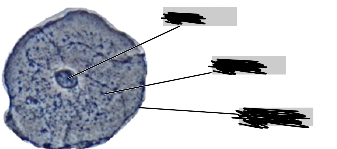 <p>label this squamous cell (top to bottom)</p>