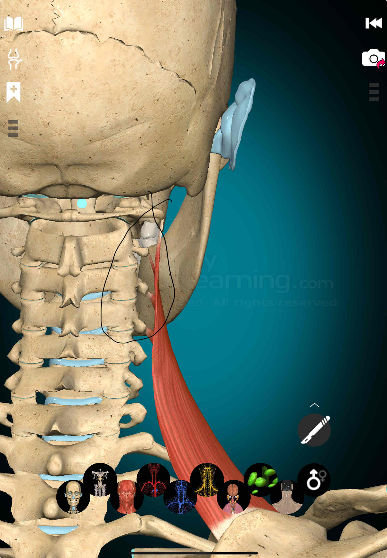 <p>Levator Scapulae Origin</p>