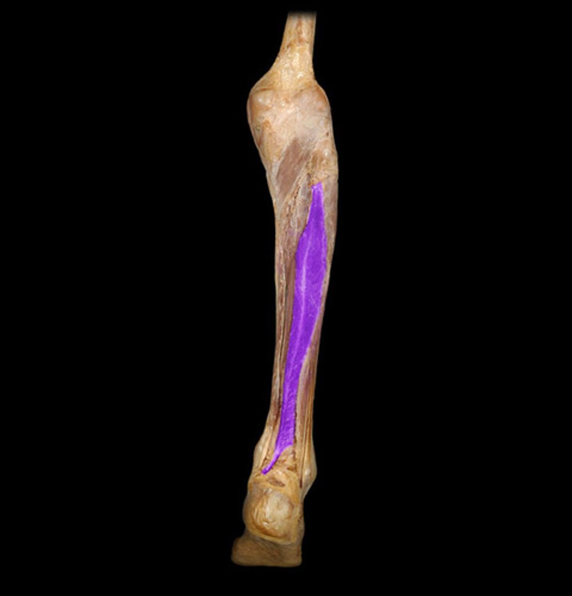 <p>Proximal attachment: Fibula</p><p>Distal attachment: Distal phalanx of digit 1</p><p>Comments, Applications and Relationships: Feather-like lateral muscle in the deep, posterior compartment of the leg.</p><p>Action: Flexor of the toes (digit 1), plantarflexes ankle</p>