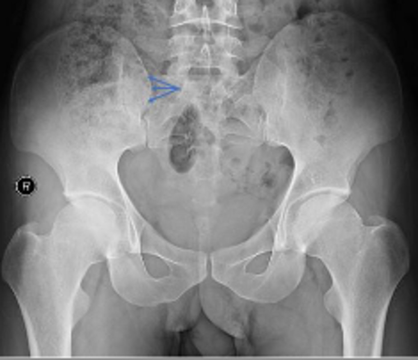 <p>What are the arrows pointing to?</p>