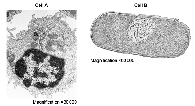 <p>The figure shows transmission electron micrographs of two cells, one animal cell and one prokaryotic cell.</p><p>Contrast the structure of the two cells visible in the electron micrographs shown in the figure above. (5 marks)</p>