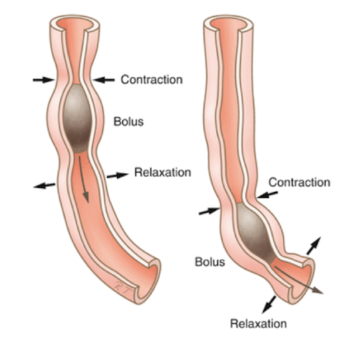 <p>Shorten Tract</p><p>-force more circular fibers into a smaller space</p><p>-reduces force individual circular fibers must produce</p>
