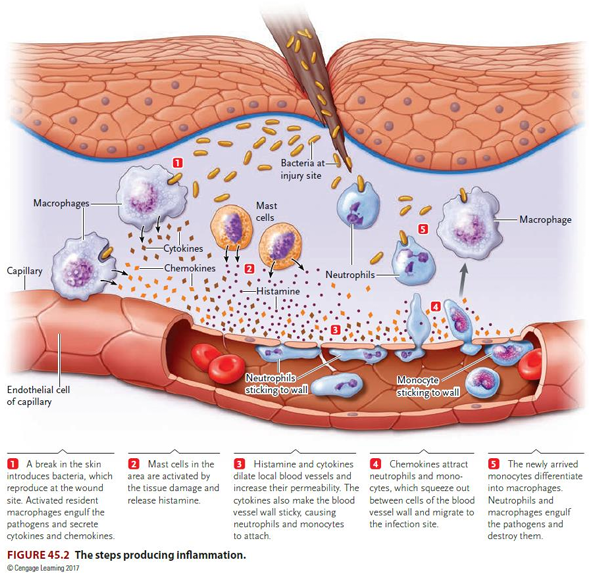 <ol><li><p>bacteria introduced at wound site. activated <strong>macrophages </strong>engulf the pathogens and secrete <strong>cytokines and chemokines</strong></p></li><li><p><strong>mast cells</strong> in the area are activated by the tissue damage and release <strong>histamine</strong></p></li><li><p><strong>histamine and cytokines</strong> dilatate local blood vessels and increase their permeability. The cytokines also make the vessel wall sticky, causing <strong>neutrophils and monocytes</strong> to attach.</p></li><li><p><strong>chemokines</strong> attract <strong>neutrophils and monocytes</strong>, which squeeze out of the blood vessel wall and migrate to the infection site</p></li><li><p>newly arrived <strong>monocytes </strong>differentiate into <strong>macrophages</strong>. <strong>neutrophils and macrophages</strong> engulf pathogens and destroy them.</p></li></ol><p></p>