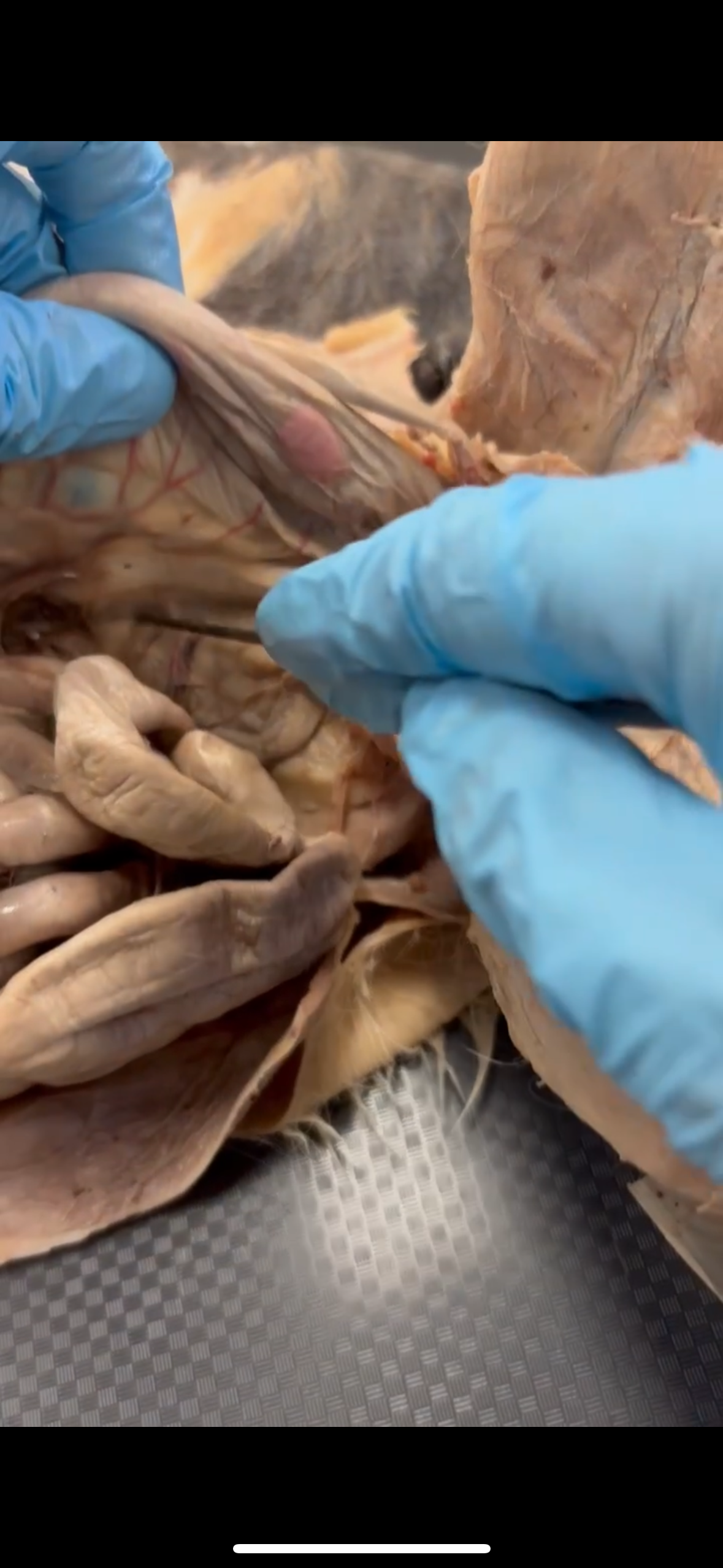 <p>Connects descending colon to back wall</p>