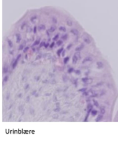 <p>Angiv epitheltypen</p>