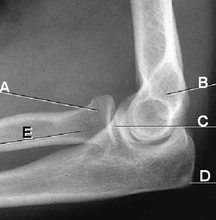 The structure identified by the letter "C" in the figure above is the: