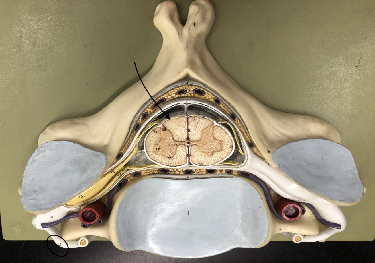 <p>what is this part of the vertebrae (of the spinal cord?)</p>