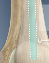 <p>A tendon that attaches the quadriceps muscle to the patella, it plays a crucial role in extending the knee and supporting leg movements. </p>