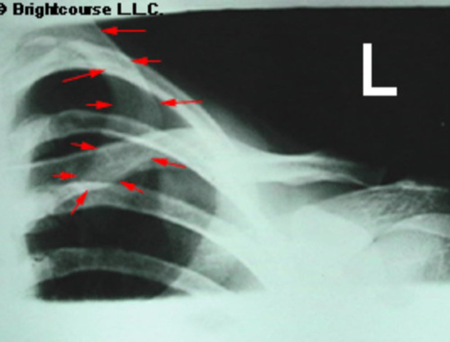 <p>What is being pointed out by the arrows in the image?</p>