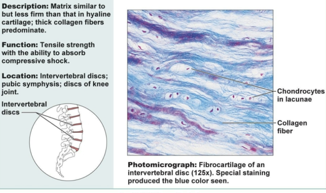 <p>Matrix similar to but less firm than that in hyaline cartilage; thick collagen fibers dominate. Functions to be strong and absorb compressive shock. Located in invertebral disks </p>