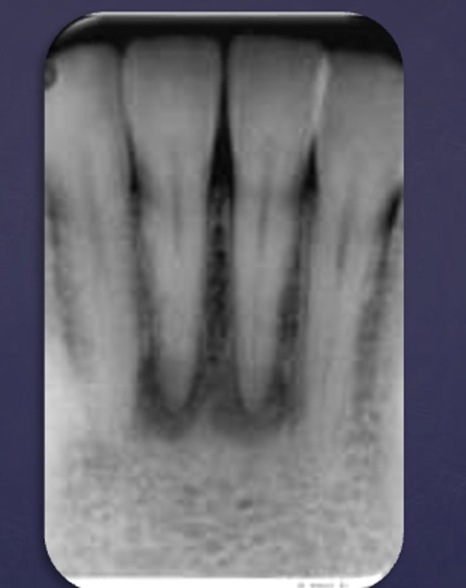 <p>What category would this lesion be part of?</p>