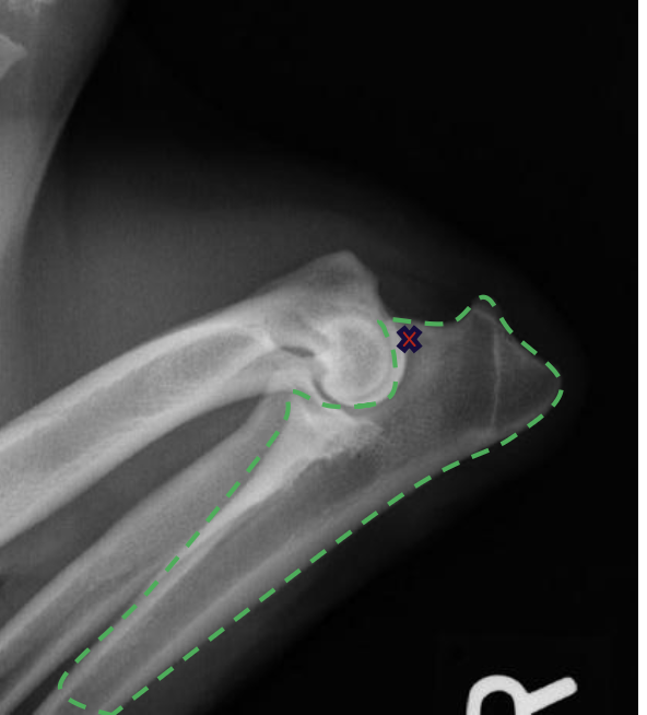 <p>how does the olecranon process extend on a lateral view?</p>