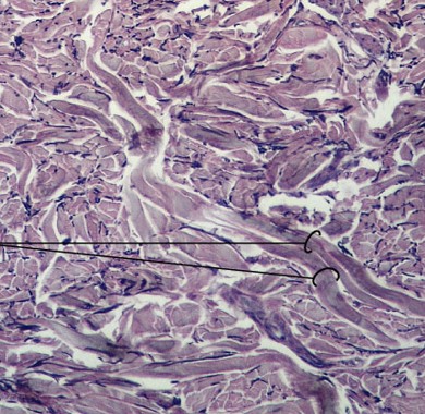 <p>Which type of connective tissue has:</p><ul><li><p>Strength in many directions</p></li><li><p>Interwoven networks of collagen fibers</p><ul><li><p>layered in skin, around cartilages, around bones</p></li><li><p>form capsules around some organs</p></li></ul></li></ul><p></p>