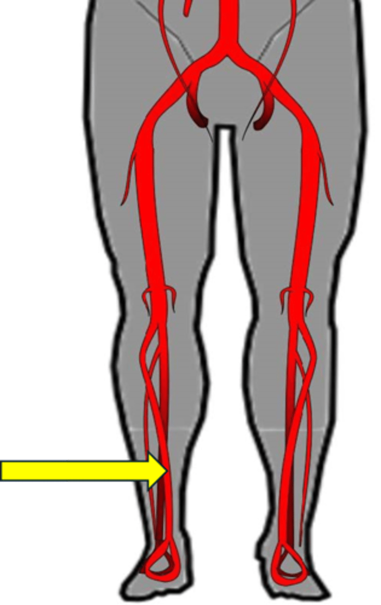 <p>Name the red vessel.</p>