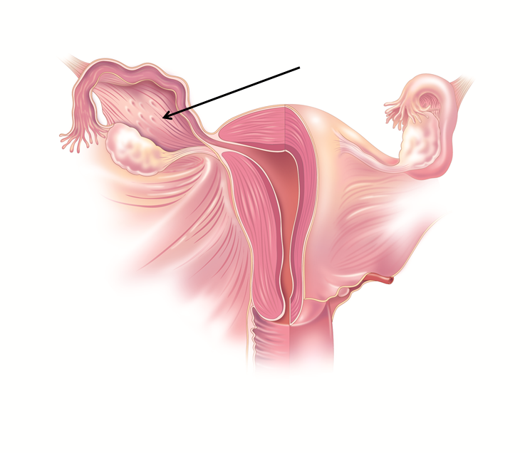 <p>Identify the structure indicated by the arrow</p>
