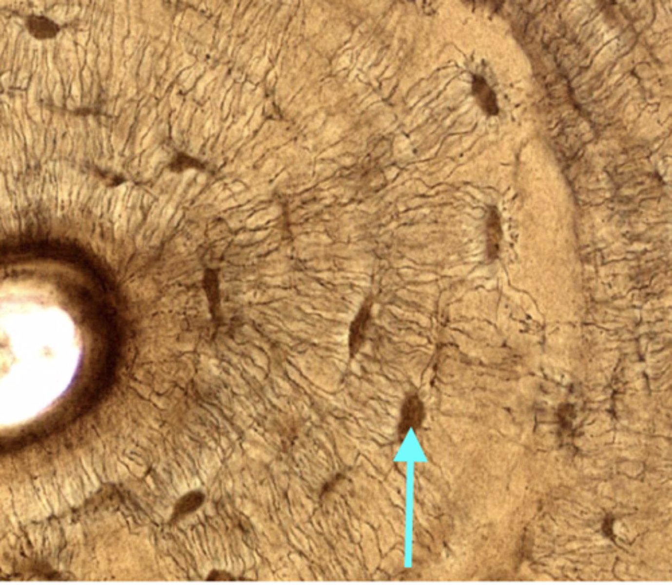 <p>Small cavities between the lamellae which contain osteocytes.</p>