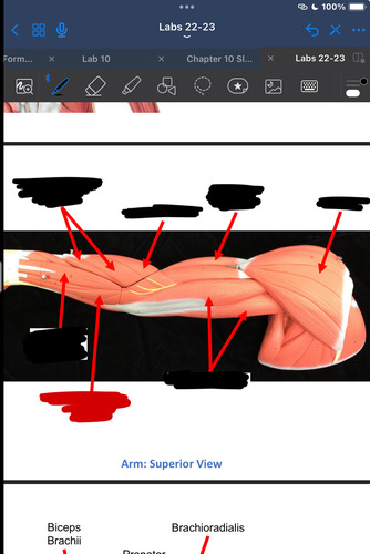 <p>What muscle is this?</p>