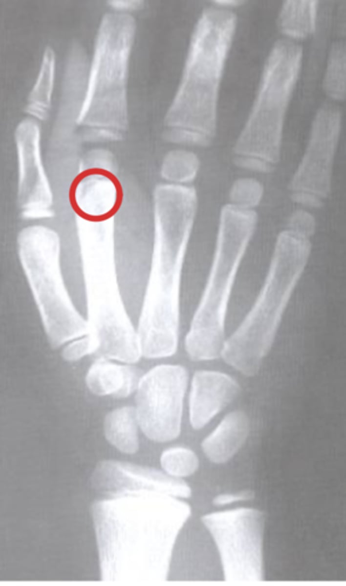 <p>How old do you think this patient is?</p>