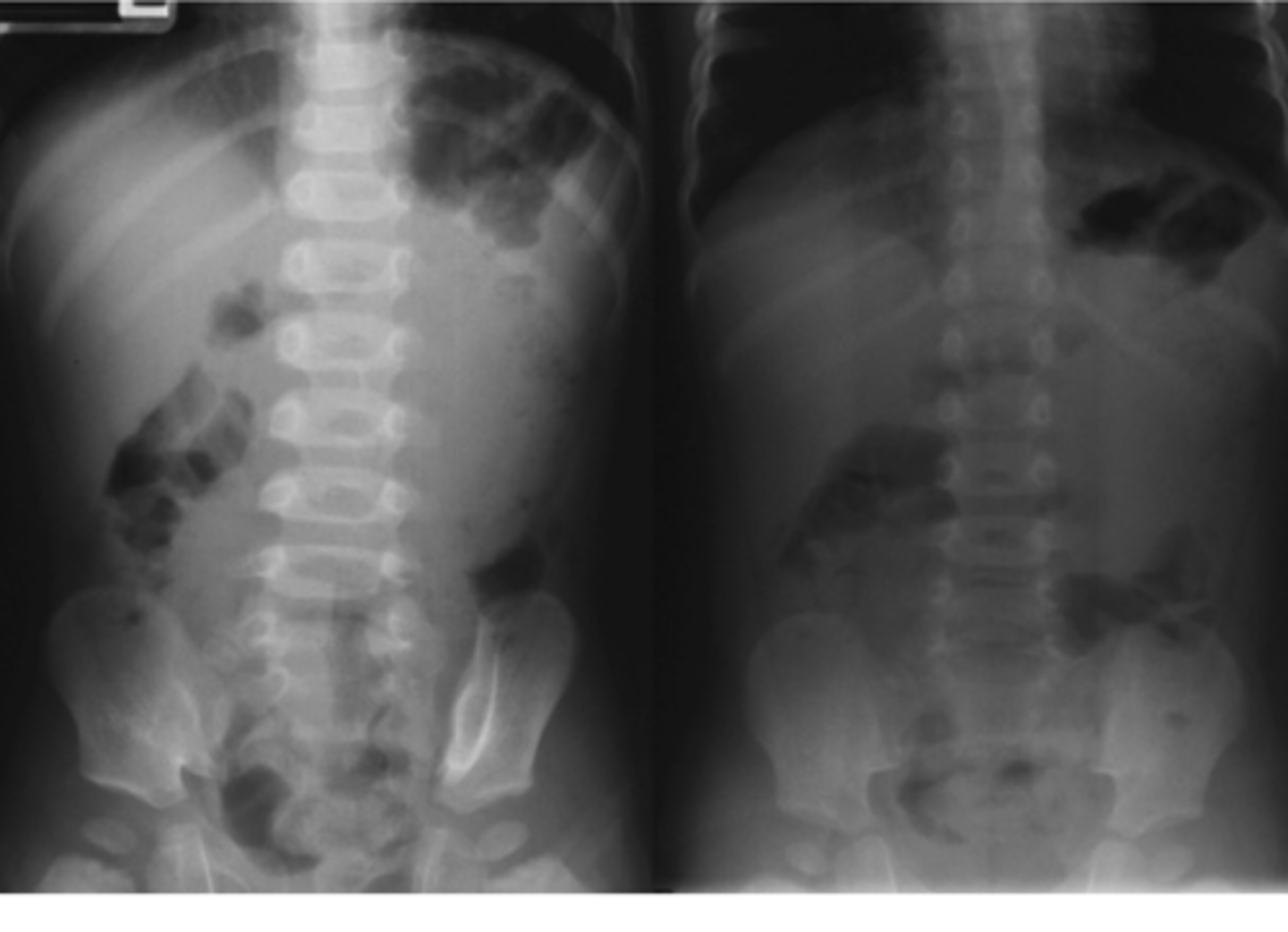 <p>identify what this is</p>