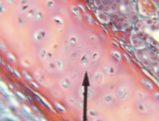 <p>what kind of cartilage is this </p>