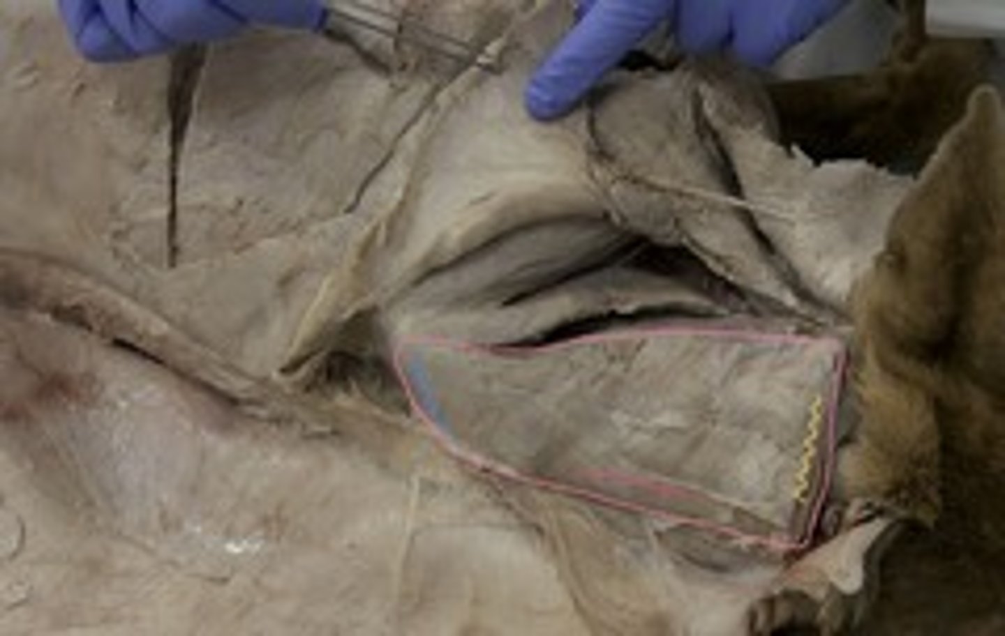 <p>(porciones torácica, cervical y cefálica):</p><p>Origen: lig de la nuca</p><p>Inserción: inserta en el borde dorsal de la escápula.</p><p>Función: fijador de la escápula, anteversor hombro, eleva miembro</p><p>Inervación: ramos dorsales de n. cervicales y de los primeros n. torácicos.</p>