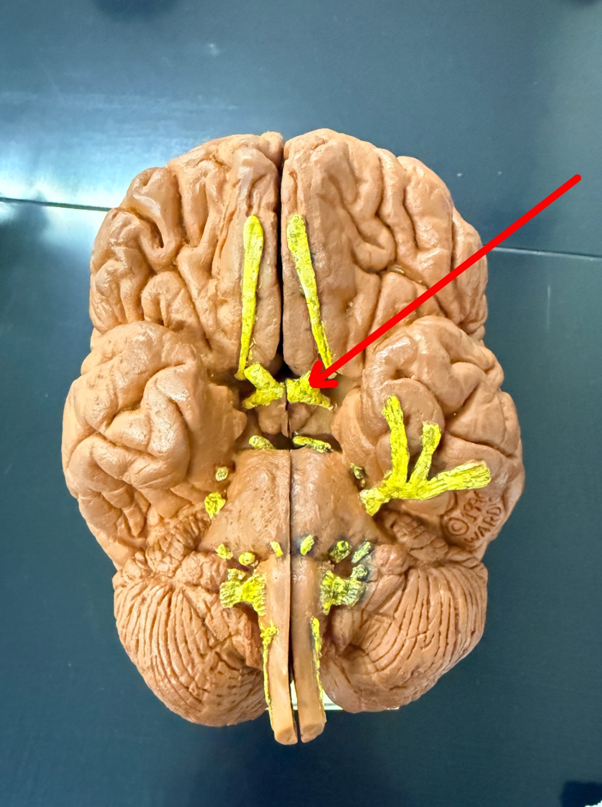 <p>Name the cranial nerve on the brain model</p>
