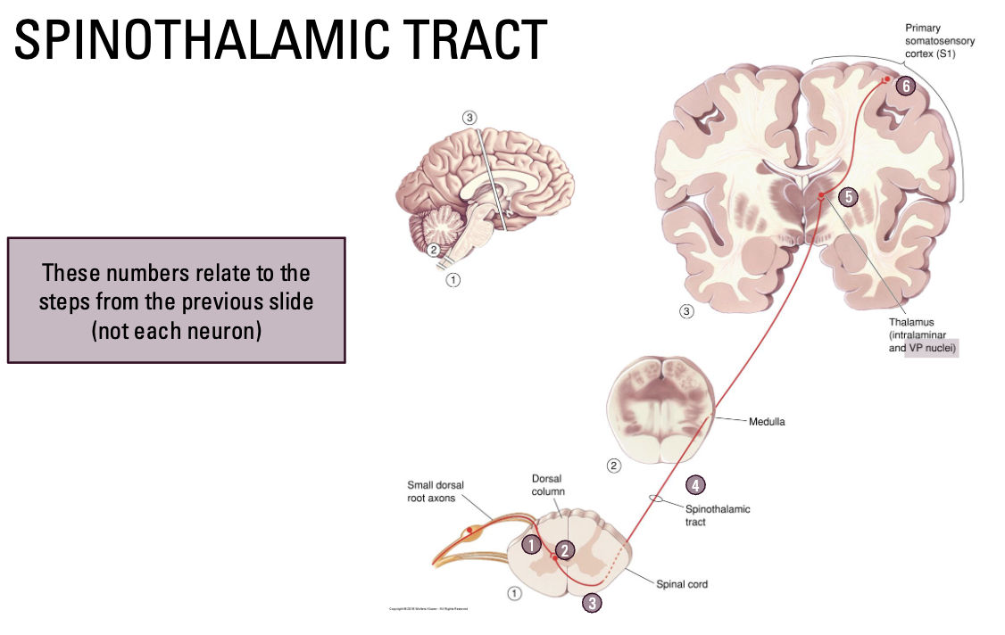 <ol><li><p><em>Enter zone of Lissauer (<u>ascend or descend slightly</u>)</em></p></li><li><p><u>Synapse</u> in the substantia gelatinosa (in the dorsal horn)</p></li><li><p>Second order neurons in the spinal cord <u>immediately decussate</u></p></li><li><p>Ascend to the brain in the ventrolateral surface of the spinal cord</p></li><li><p>Synapse with VP nucleus (and other areas) in the thalamus</p></li><li><p>Information then projected the somatosensory cortex</p></li></ol><img src="https://knowt-user-attachments.s3.amazonaws.com/ed32671c-49f1-47b4-b54f-64cfe351f1e8.png" data-width="50%" data-align="center" alt=""><p><em>NOTE: Pain is complex and can be difficult to localize in the brain. It is also highly integrated with medial structures related to emotion/memory</em></p>