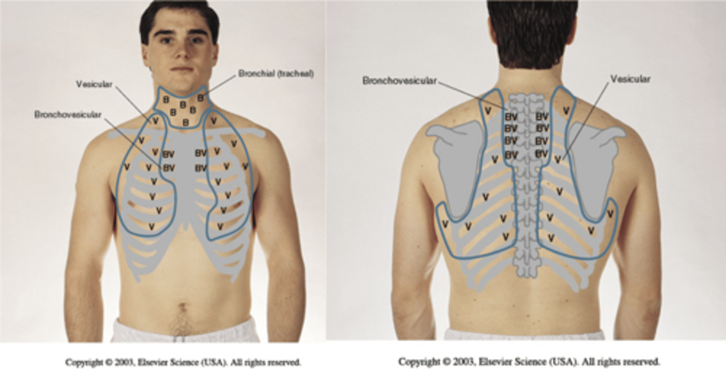 <p>A. Bronchial</p><p>B. Bronchovesicular</p><p>C. Vesicular</p>