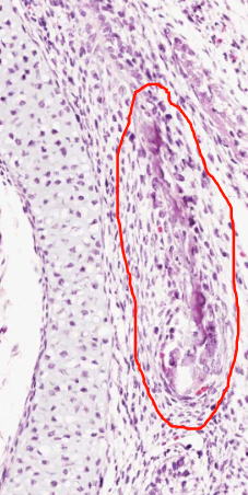 <ol><li><p>By what process will the bone in the encircled area develop</p></li></ol><p>Foetal head, coronal section, haematoxylin and eosin</p>