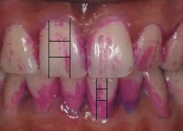 <p>score for #8 F and #24 F</p>